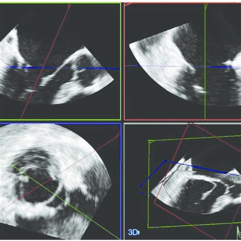 Components Of An Ultrasound Transducer Download Scientific Diagram