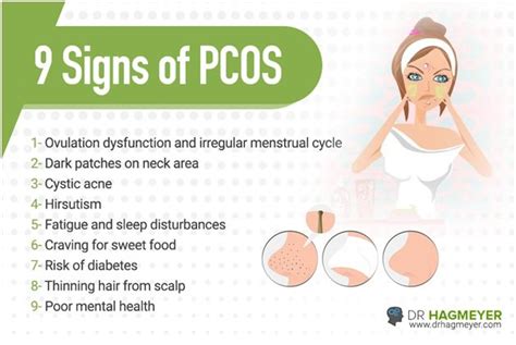 9 Signs You Might Have PCOS Dr Hagmeyer