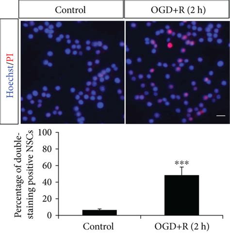 Ogd Reoxygenation Induced Nsc Apoptosis The Nscs Cultured In The