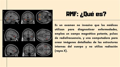 SOLUTION Resonancia Magn Tica Funcional Y Electroencefalograma Studypool