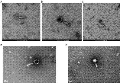 Frontiers Isolation And Characterization Of Novel Fusobacterium