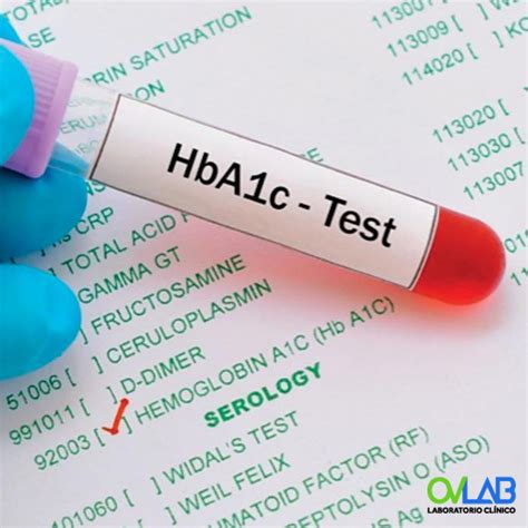 HEMOGLOBINA GLICOSILADA HbA1c OVLAB O V Laboratorios