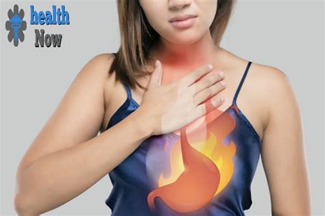 Symptoms And Causes Of Heartburn Disease Diagnosis And Treatment