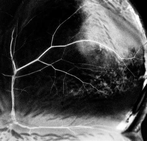 Seeing Your Retina: Perception & Life Science Activity | Exploratorium ...