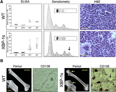 The Differentiation And Stress Response Factor XBP 1 Drives Multiple