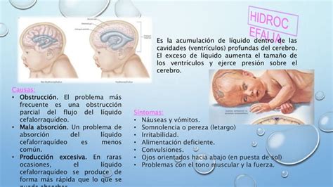 Semiolog A De Cabeza Y Cuello Pptx