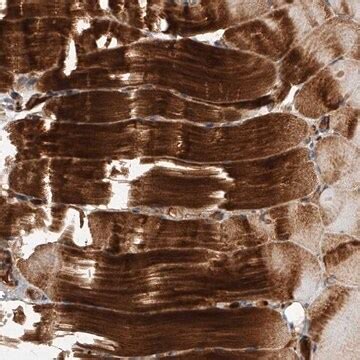 anti usp antibody produced  rabbit anti clb anti eefal