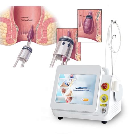 980nm 1470nm Hemorrhoids Piles Fistula Laser Ablation Proctology Laser