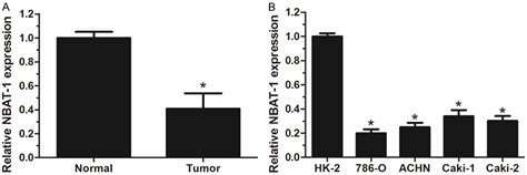 Decreased Expression Of Long Non Coding Rna Nbat 1 Is Associated With