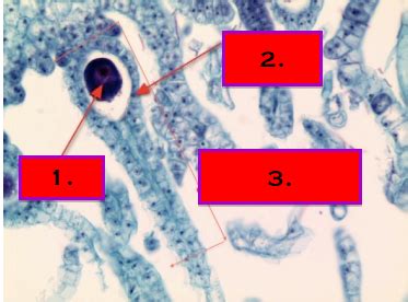 Botany Nonvascular Plants Flashcards Quizlet