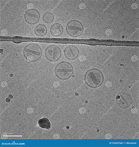 Micrograf A Con Nanopart Culas De L Pidos Que Contienen Un F Rmaco