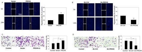 The Influence Of PRDX6 On The Cell Migration And Invasion Of Cervical