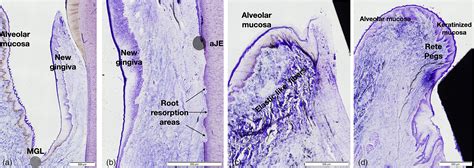 Alveolar Mucosa Histology