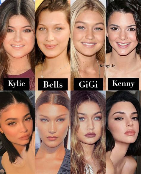 Beauty Yes Artificial One Kylie Jenner Plastic Surgery Celebrity