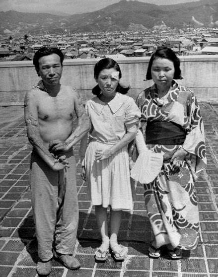 Hiroshima: Photos of Survivors of the World's First Atomic Attack | Time.com