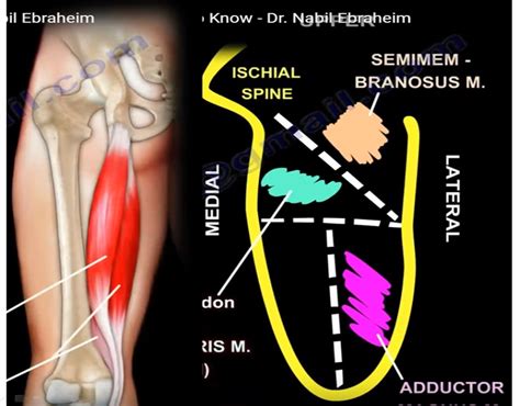 Anatomy of the Semitendinosus Muscle — OrthopaedicPrinciples.com