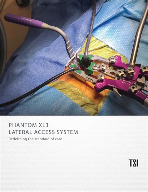 Pdf Phantom Xl Lateral Access System Tedan Xl S Top Loading