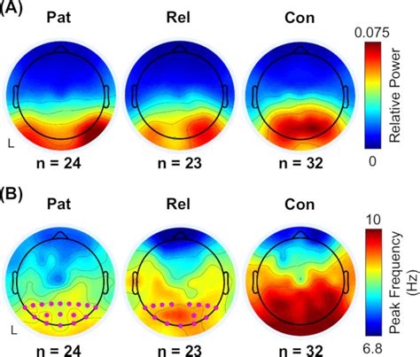 Eeg Topographical Plots For The Alpha Band Group‐averaged Eeg Download Scientific Diagram