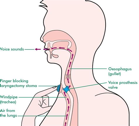 Labelled Diagram Of Voice Box