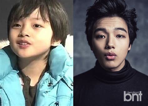 Yeo Jin Goo Plastic Surgery Terbaru