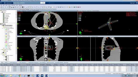 Ezfluence 2 1 3d Conformal Planning Any Site Any Beam Arrangement Youtube