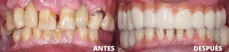 Pr Tesis Dental Gonz Lez Y Casado