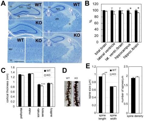 (A) Histological examination of the hippocampus, thalamus, and cerebral ... 