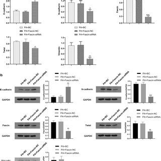 Rt Pcr And Western Blotting Were Used To Detect The Expression Of