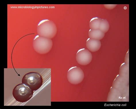 E Coli Colony Morphology On Blod Agar Colonies Without Hemolysis