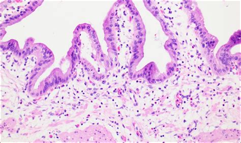 Gallbladder Normal Histology Nus Pathweb Nus Pathweb