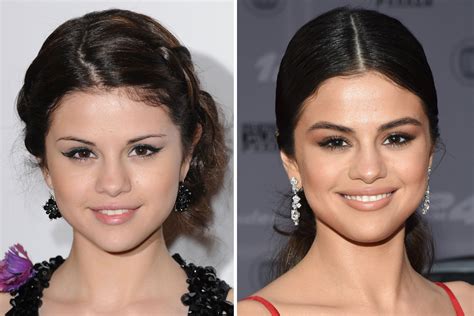 Selena Gomez Teeth Fix