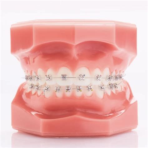 Legend Mini Rhodium Mbt Mandibular Gc Orthodontics Inc