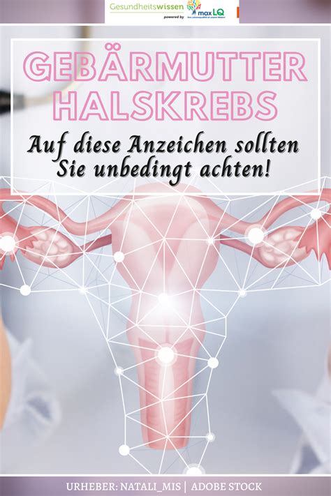 Geb Rmutterhalskrebs Erste Anzeichen Symptome So Erkennen Sie