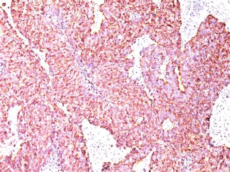 Chromogranin A Cga Abcam