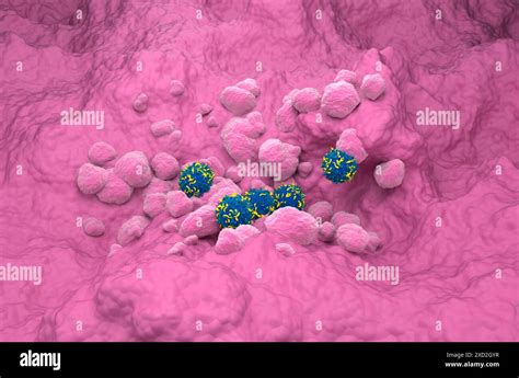 Car T Cell Therapy In Lung Cancer Isometric View 3d Illustration