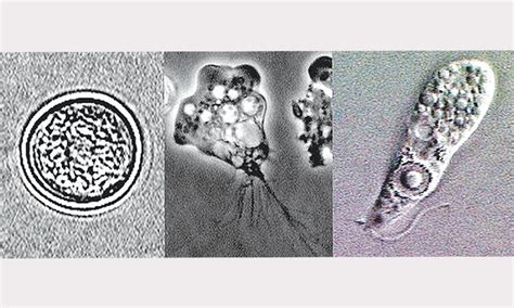 Naegleria Fowleri: Barricading the brain against the amoeba - Pakistan ...