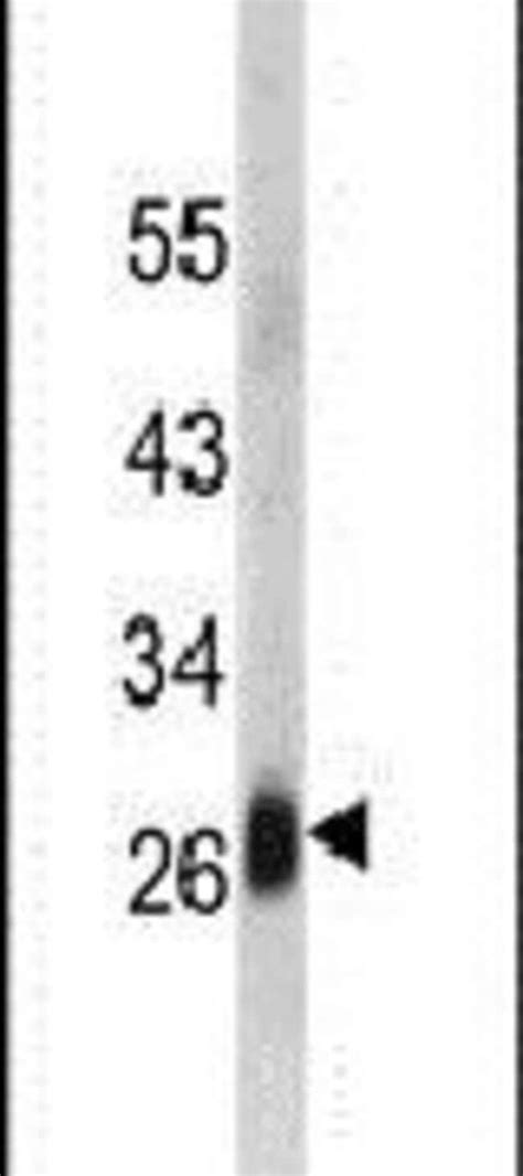 DCL 1 Polyclonal Antibody Invitrogen 400 μL Unconjugated Antibodies