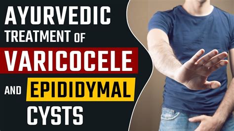 Ayurvedic Treatment Of Epididymal Cyst Dr Health Youtube