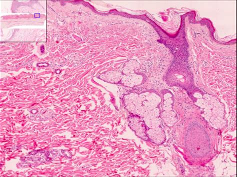 Integumentary System Diagram Quizlet