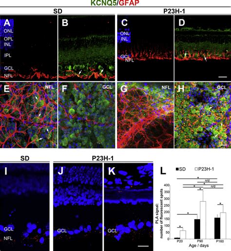 Gfap Expression And Co Localization With Kcnq5 In The Central Retinal