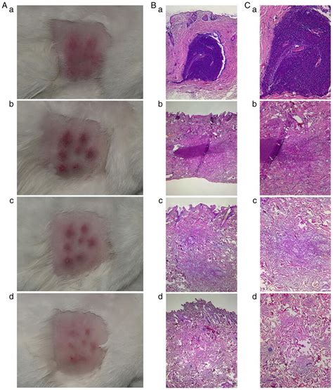 Appearance And H E Staining Of Skin Lesions At The 4th Week Of