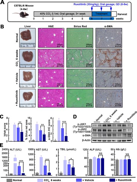 Ruxolitinib Accelerates The Reversal Of Liver Fibrosis In Ccl4 Mouse