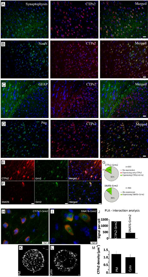 Figure 3 From Glutamine Uptake Via SNAT6 And Caveolin Regulates