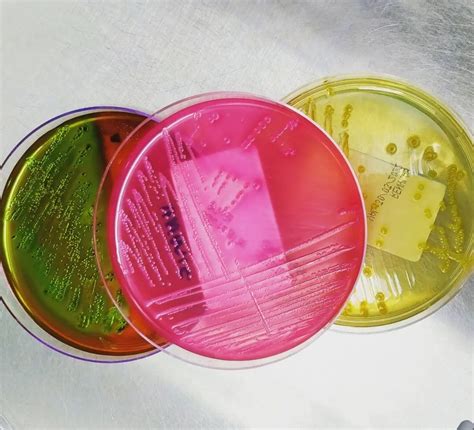 Microbio On Twitter Escherichia Coli Agar Emb Agar Macconkey Agar