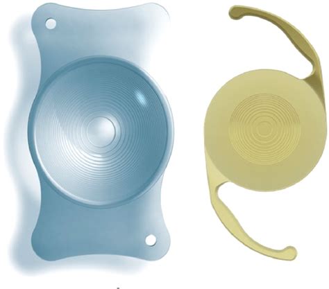 Figure 1 From Comparison Of The Visual Outcomes After Cataract Surgery With Implantation Of A