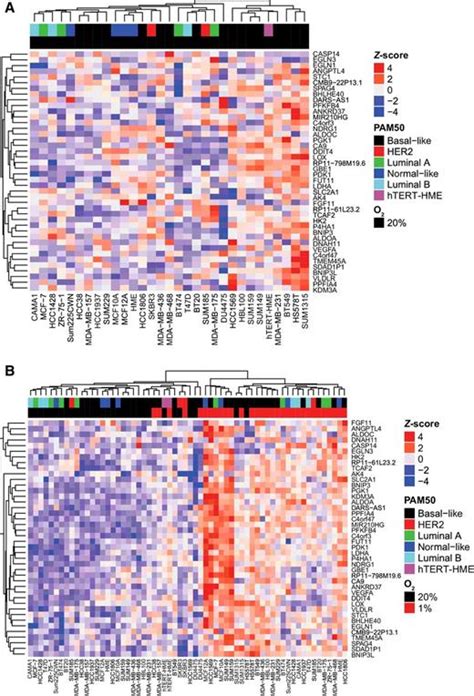 Molecular Portrait Of Hypoxia In Breast Cancer A Prognostic Signature