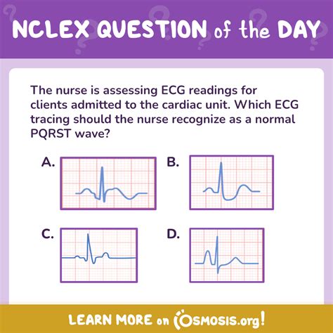 Study Tips: NCLEX® QOTD: Normal PQRST wave