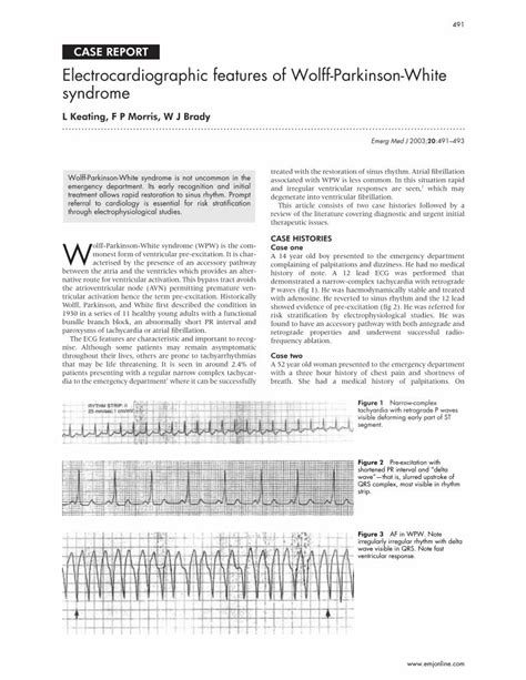 Pdf Electrocardiographic Features Of Wolff Parkinson White Syndrome