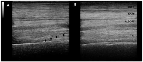 Scielo Brasil Ultrasound Guided Biopsy Of The Equine Forelimb