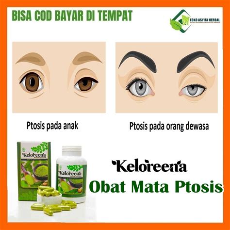 Jual Obat Mata Ptosis Obat Kelopak Mata Kendur Obat Kelopak Mata